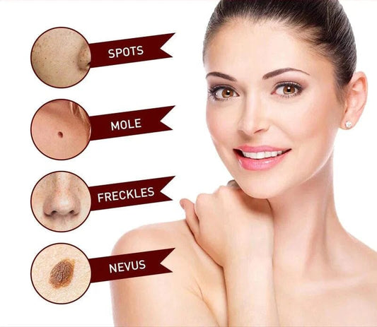 Tags & Moles Remover (BUY 1 GET 1 FREE)