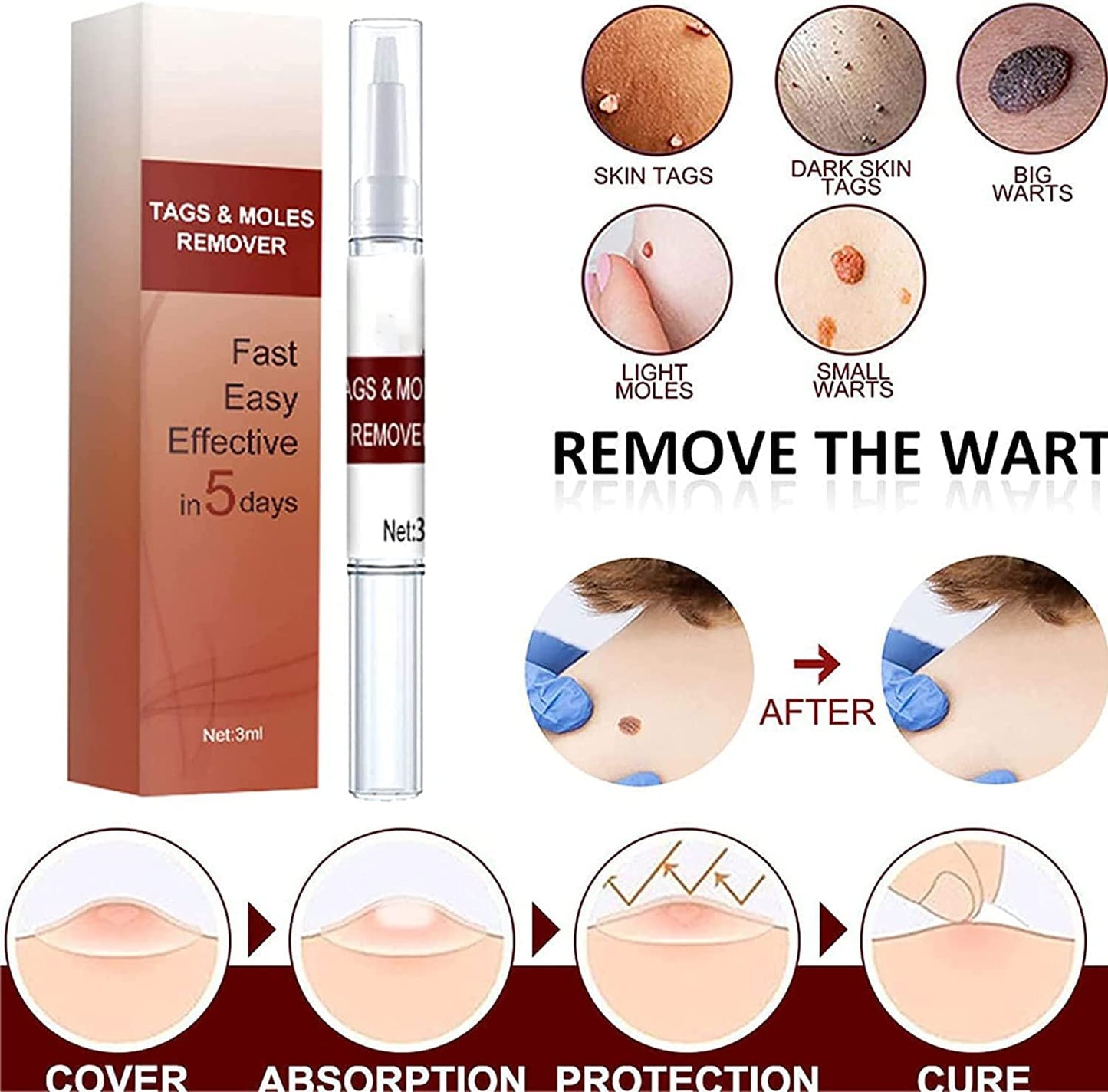 Tags & Moles Remover (BUY 1 GET 1 FREE)