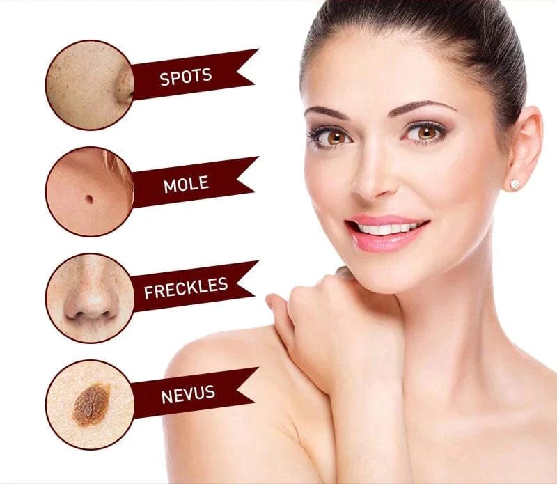 Tags & Moles Remover (BUY 1 GET 1 FREE)